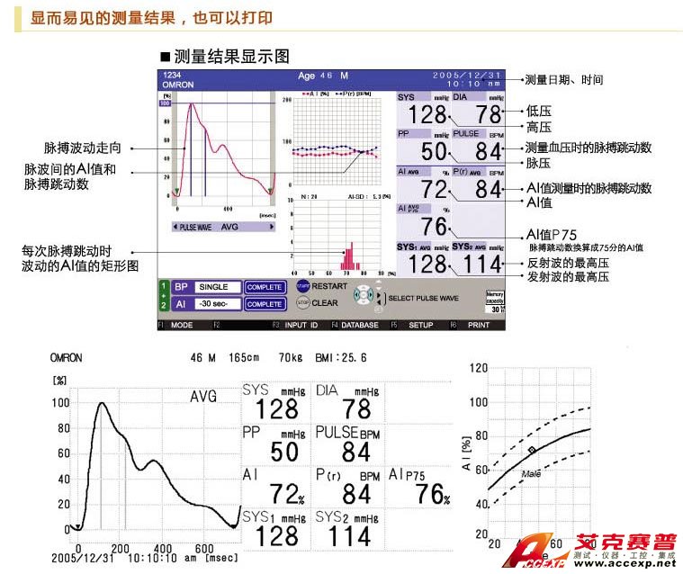 顯而易見的動脈結(jié)果