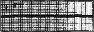 漂移數(shù)據(jù)(DC V零點)